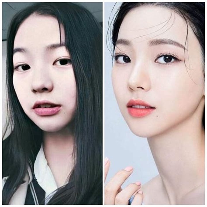 Huening Kai Nose Job: Plastic Surgery Before And After Photos